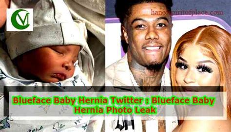 blueface baby hernia|More.